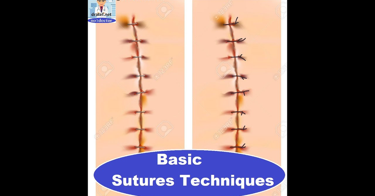 Basic Sutures Techniques &#x2F; Surgical Suture Removal &#x2F; Mrcs &#x2F; FRCS &#x2F;USMLE &#x2F; No1doctor &#x2F; dratef