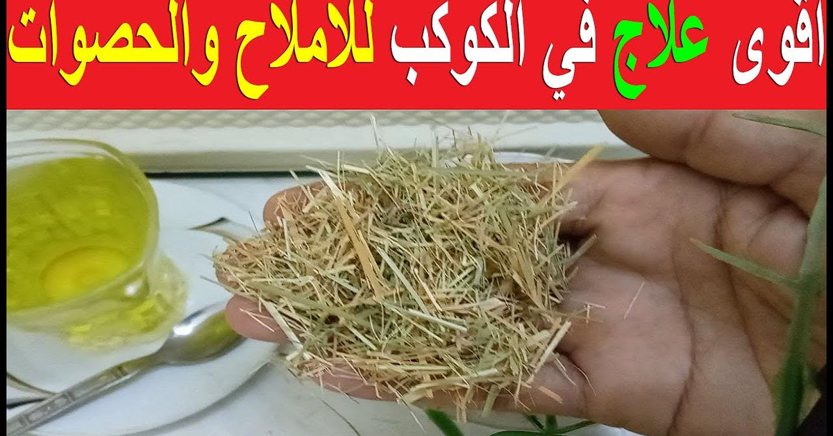 وداعاً للحصوات والأملاح مع اقوى علاج طبيعي على الكوكب بالتجربة #علاج_الأملاح