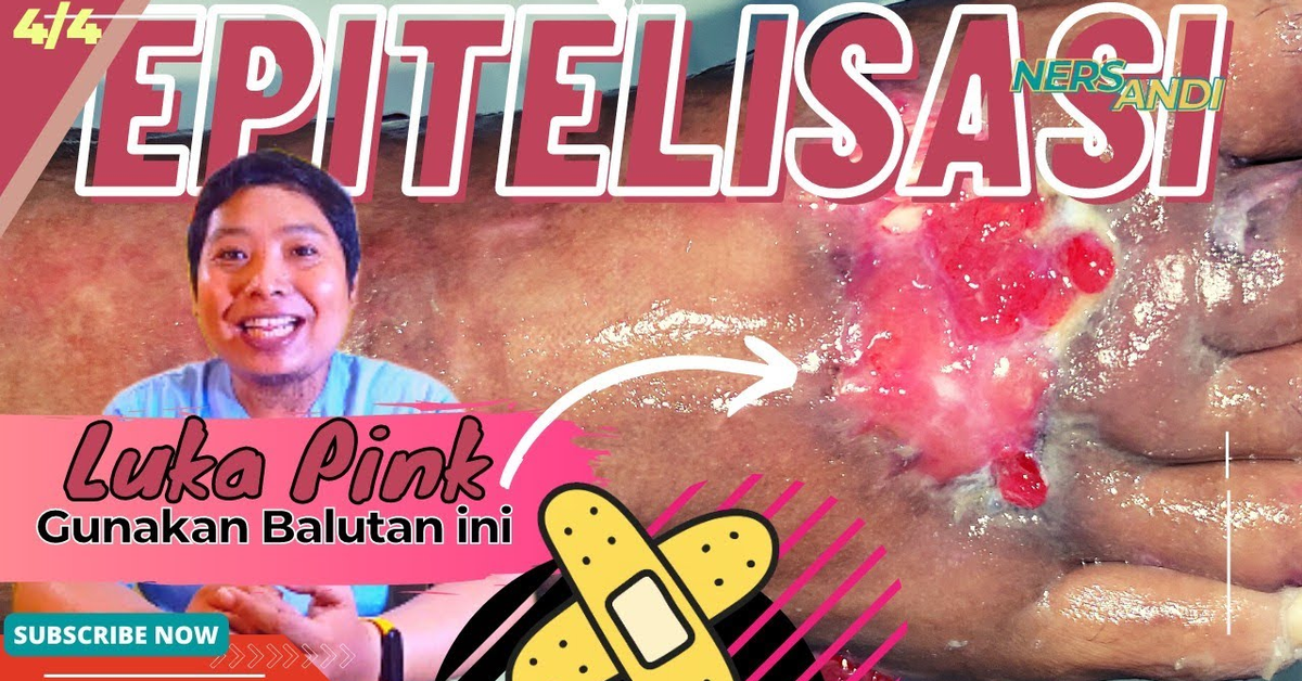 Luka warna pink, fase akhir penyembuhan luka ️ #balutanluka #perawatanluka #epitelisasi
