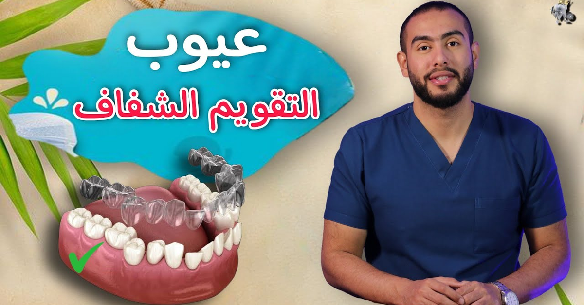 مميزات وعيوب التقويم الشفاف | اشياء يجب ان تعرفها قبل عمل التقويم الشفاف | ومده استخدامه 