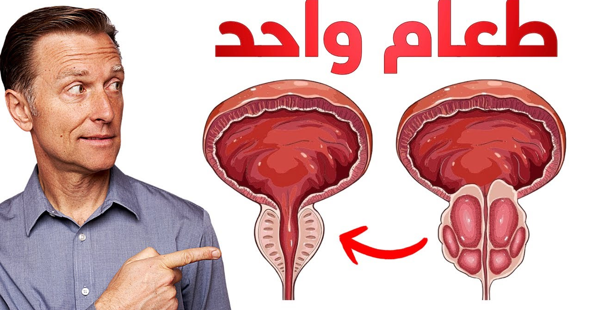 الطعام الوحيد الذي يقلص البروستاتا المتضخمة