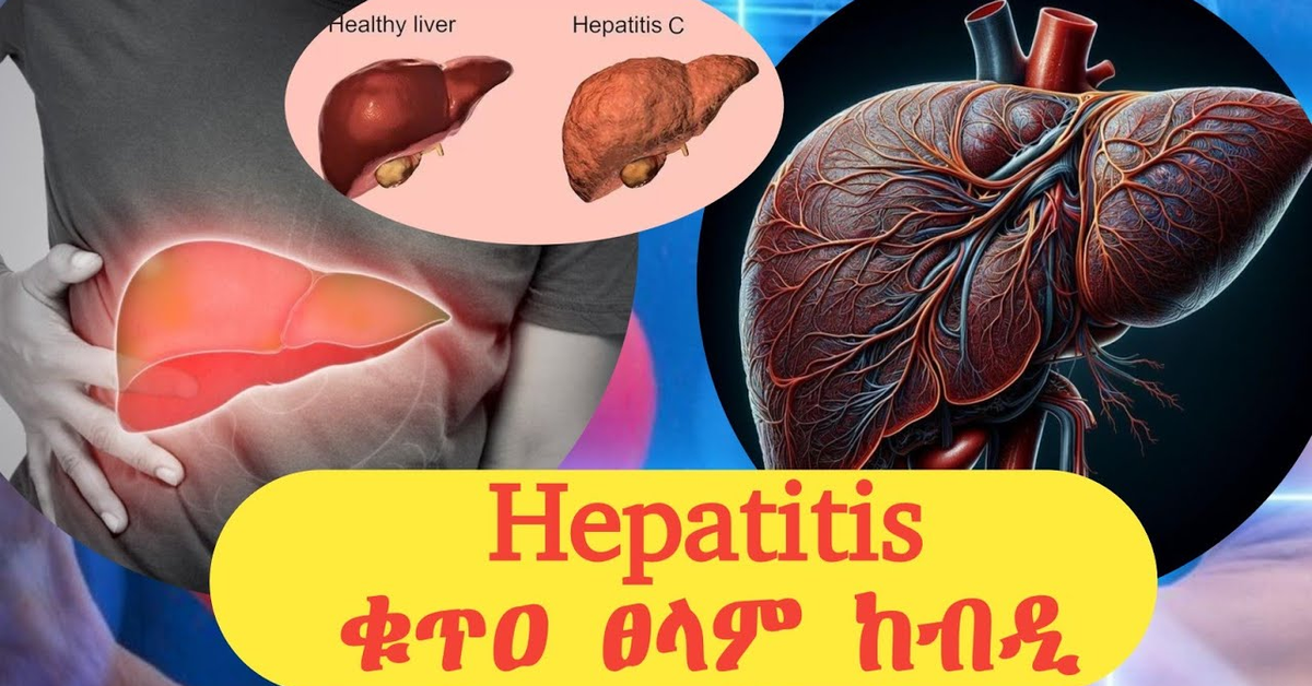 Understanding Hepatitis: Causes, Symptoms, and Prevention | ቁጥዐ ፀላም ከብዲ ወይቦ